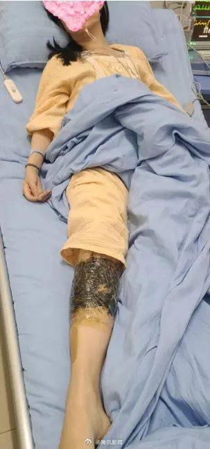 皇冠信用網会员开户_女子在云南被银环蛇咬伤打了十多支血清皇冠信用網会员开户，自称2年后仍有后遗症：头晕脸麻，没想到恢复得这么慢